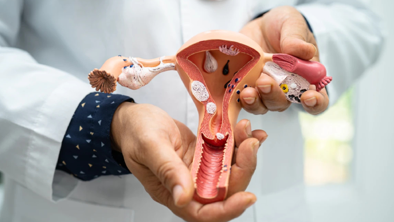 uzmani anlatti her on kadindan birinde polikistik over sendromu gorulebilir 8ITXu4fz